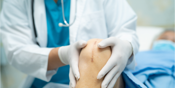 Surgical scars